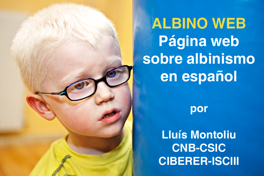 Fotografia: Ana Yturralde (Libro Albinismo-ALBA, 2009)