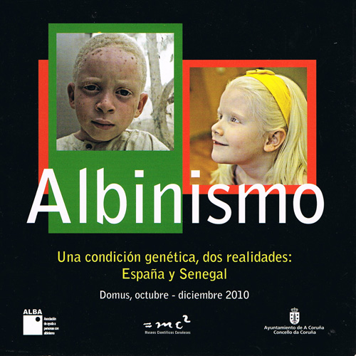 Exposicion DOMUS: Albinismo, una condición genética, dos realidades: España y Senegal
