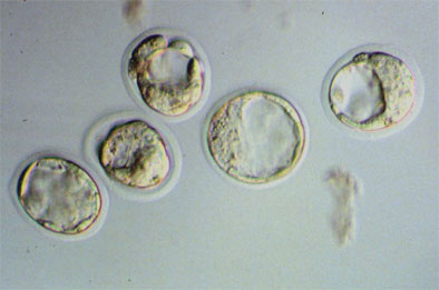 mouse blastocysts